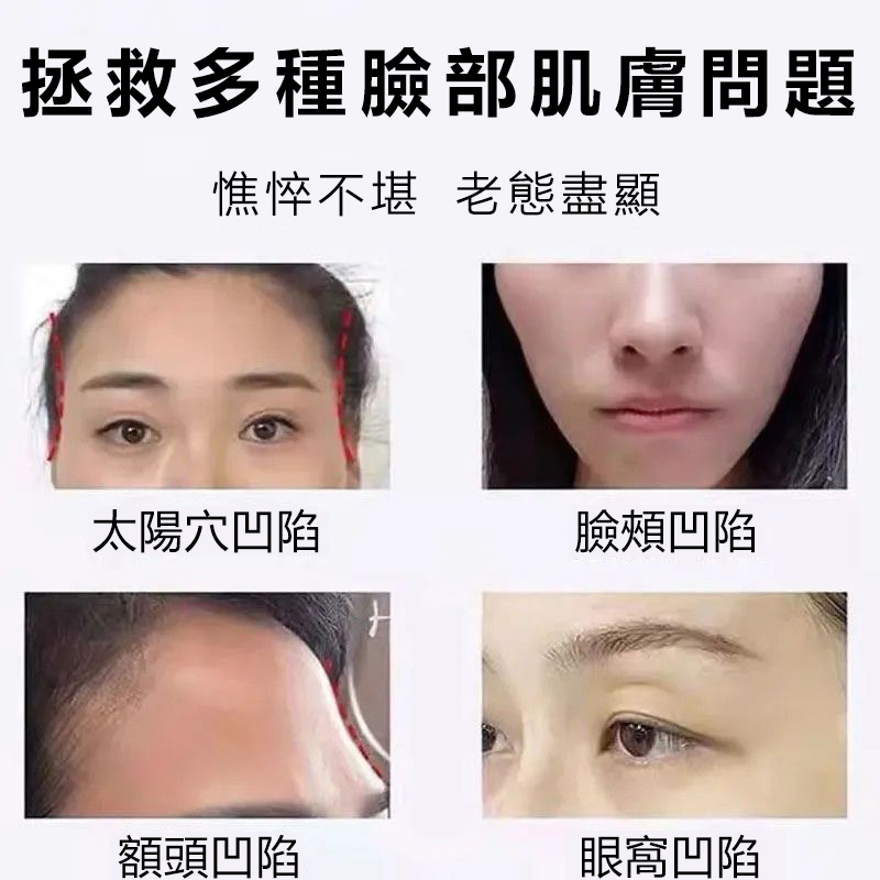 【明星力荐】【不滿意包退】魚子醬膠原蛋白填充霜法國小分子純鱘光感抗皺面霜,越用肌膚越好!裸妝自然水潤美膚!買一送一! 【明星力荐】【不滿意包退】魚子醬膠原蛋白填充霜法國小分子純鱘光感抗皺面霜,越用肌膚越好!裸妝自然水潤美膚!買一送一!