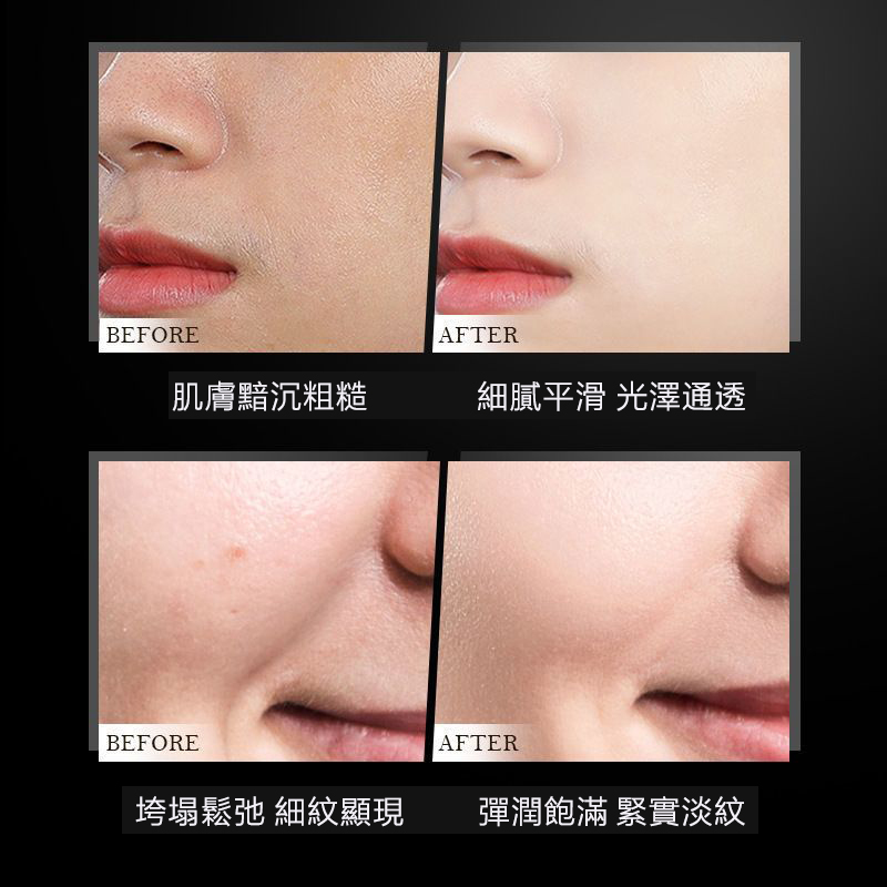 【明星力荐】【不滿意包退】魚子醬膠原蛋白填充霜法國小分子純鱘光感抗皺面霜,越用肌膚越好!裸妝自然水潤美膚!買一送一! 【明星力荐】【不滿意包退】魚子醬膠原蛋白填充霜法國小分子純鱘光感抗皺面霜,越用肌膚越好!裸妝自然水潤美膚!買一送一!